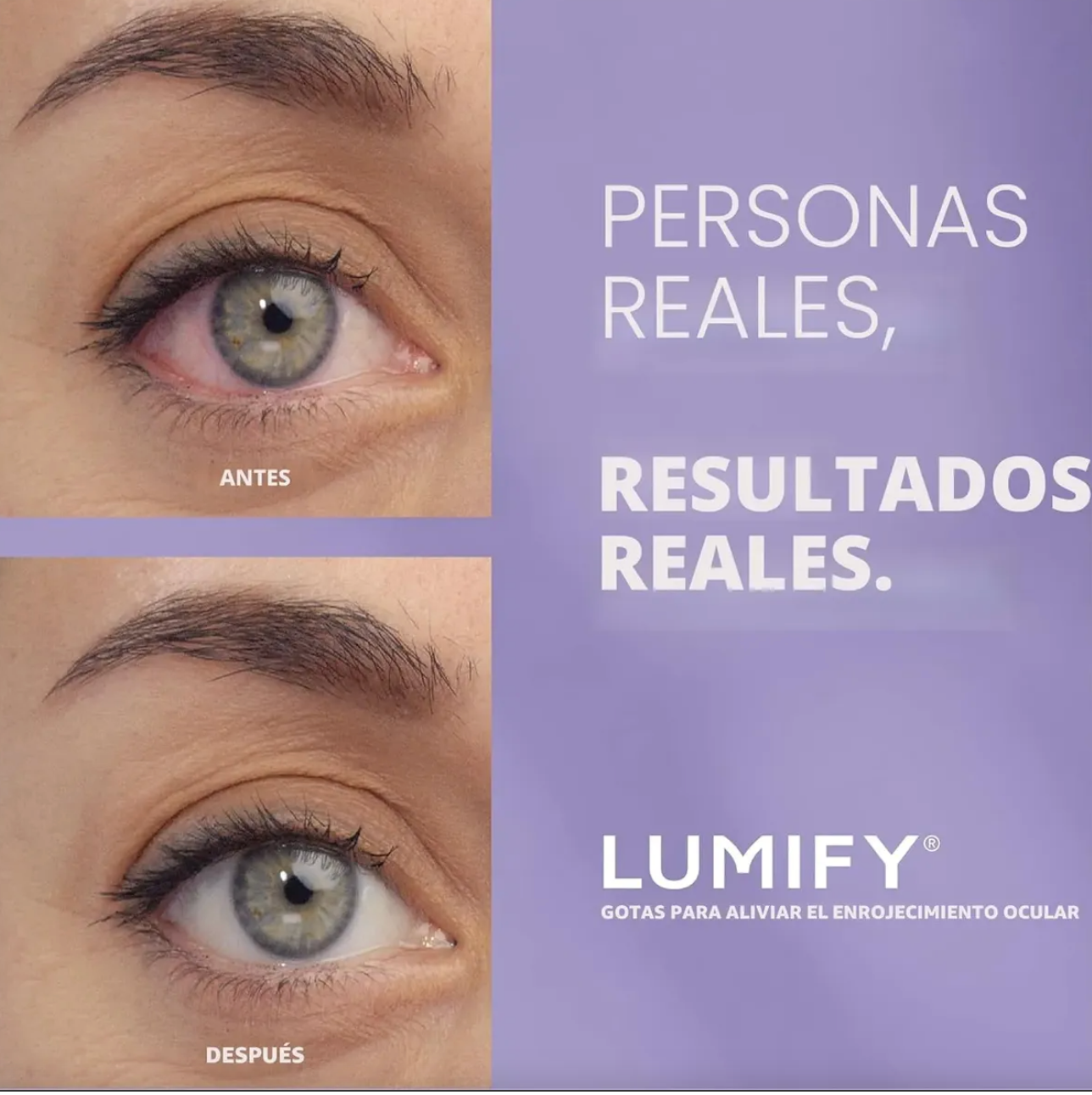 LUMIIFY - Elimina el enrojecimento en minutos