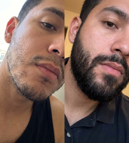 (COMPRA 1 Y LLEVATE 2) Bálsamo para Crecimiento de Barba Ultra Potente con Minoxidil 20%