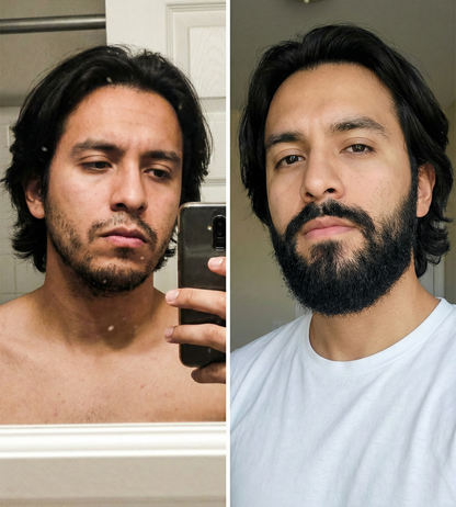 (COMPRA 1 Y LLEVATE 2) Bálsamo para Crecimiento de Barba Ultra Potente con Minoxidil 20%