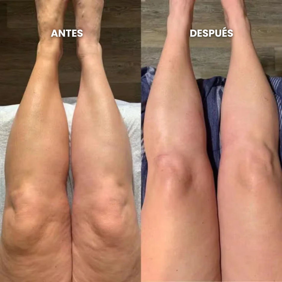 Aurelys™ - Gotas de Bienestar para Drenaje Linfático