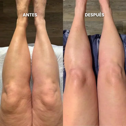 Aurelys™ - Gotas de Bienestar para Drenaje Linfático